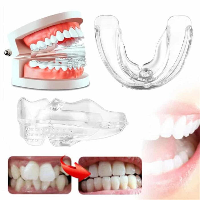 Progressive Dental Alignment Trays for Perfect Smile