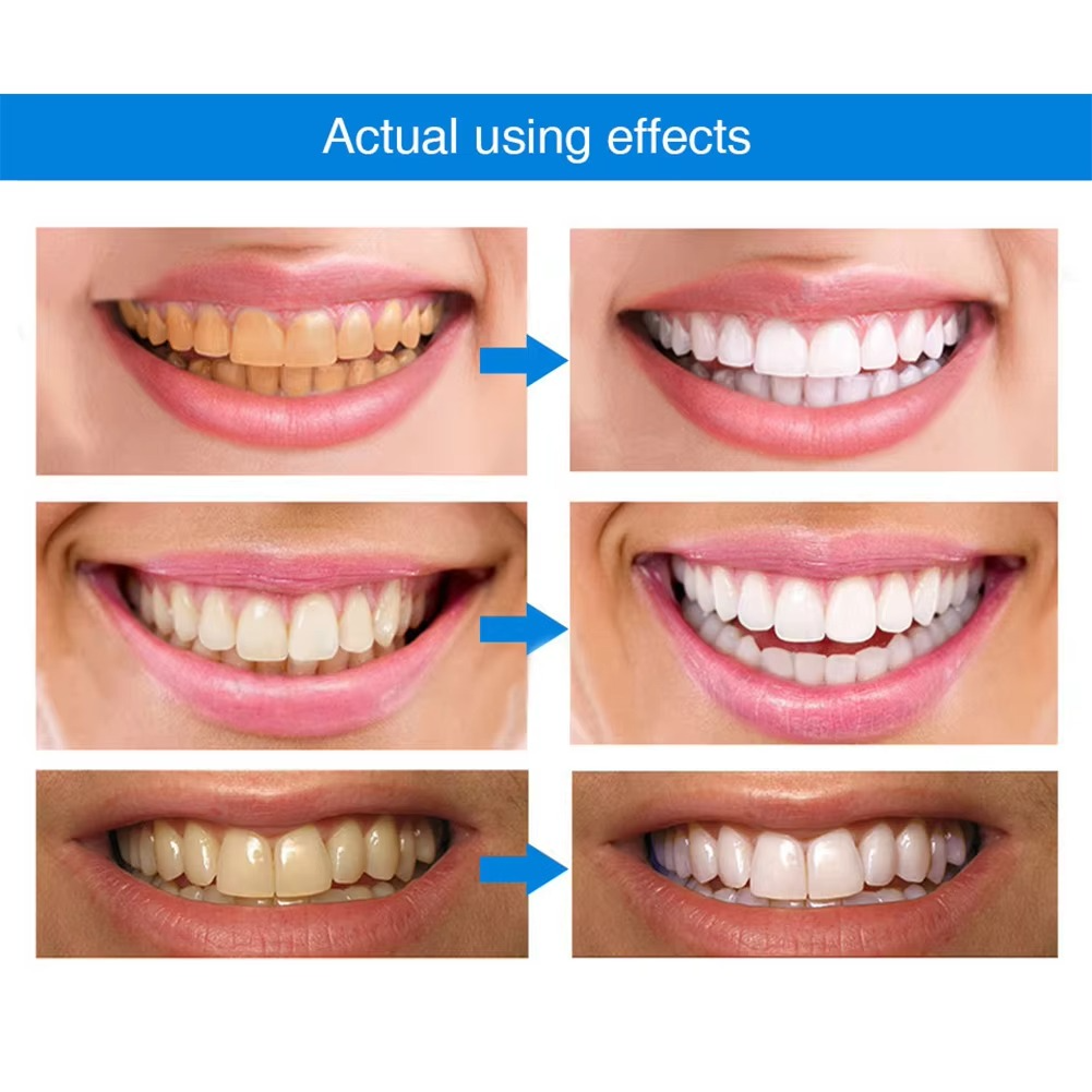 Instant Smile Brightening Pen for Whiter Teeth