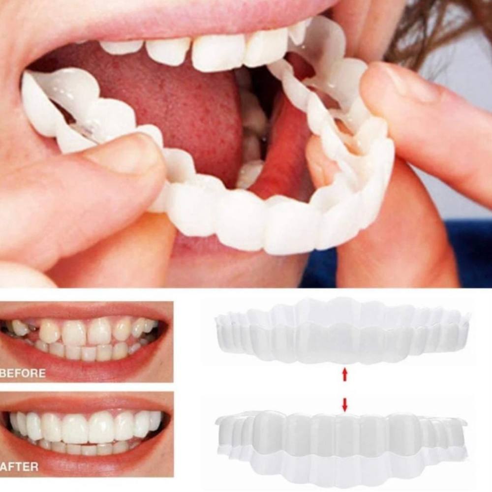 Instant Smile Enhancer for Upper and Lower Teeth