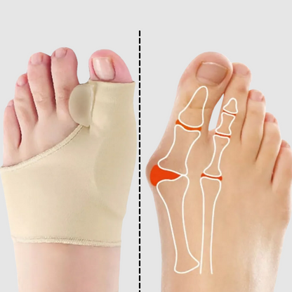 ComfortFit Bunion Relief System with Toe Spacer and Cushions