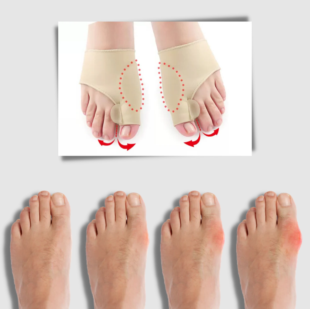 ComfortFit Bunion Relief System with Toe Spacer and Cushions