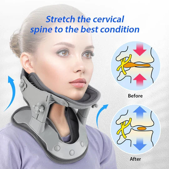 Neck Relief Traction System for Posture Improvement