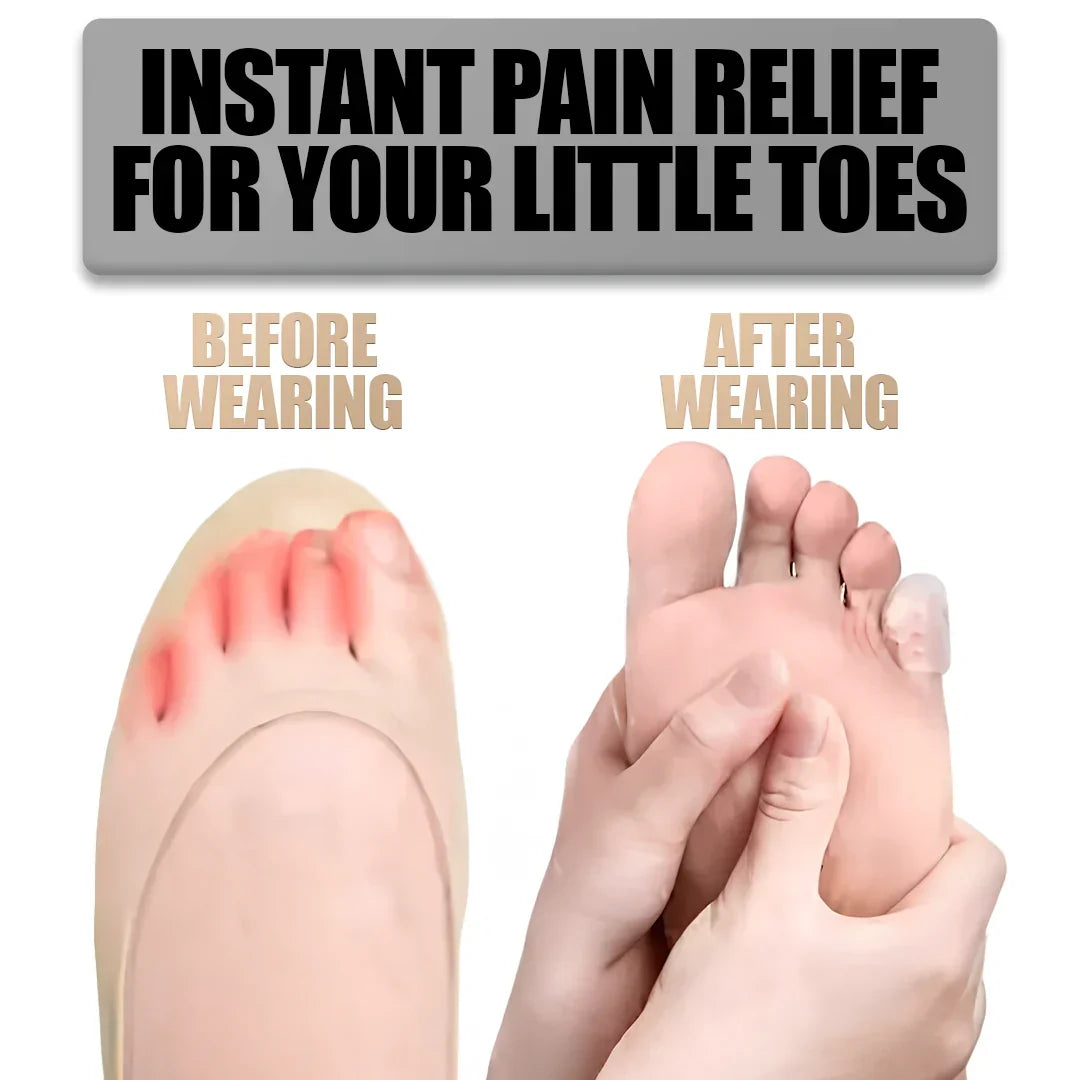 ComfortGuard Silicone Toe Shields for Pain Relief and Protection