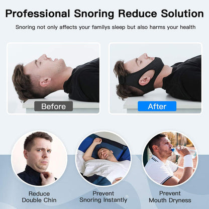 Snore Solution Sleep Support Strap for Peaceful Nights