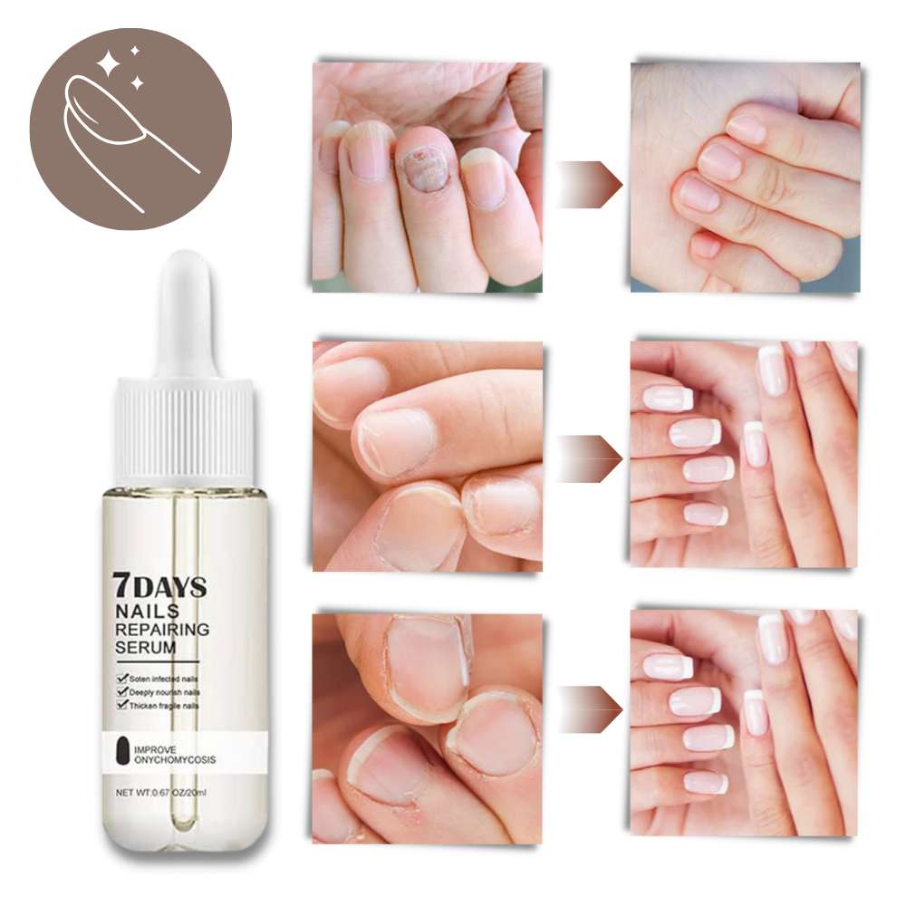 Nail Revitalizing Serum with Precision Brush, 20ml