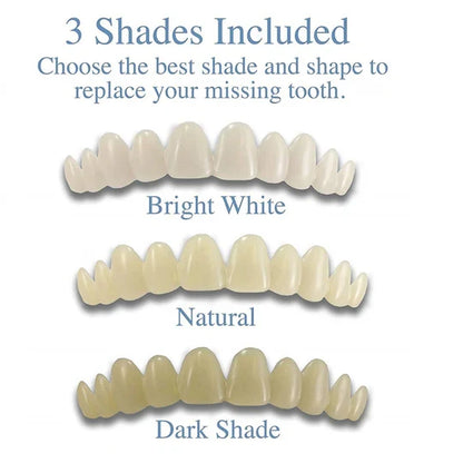 Instant Smile Enhancers - Temporary Dental Veneers