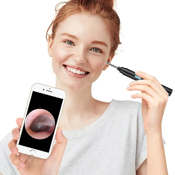 Wireless Ear Inspection Camera with 20X Zoom and App Link