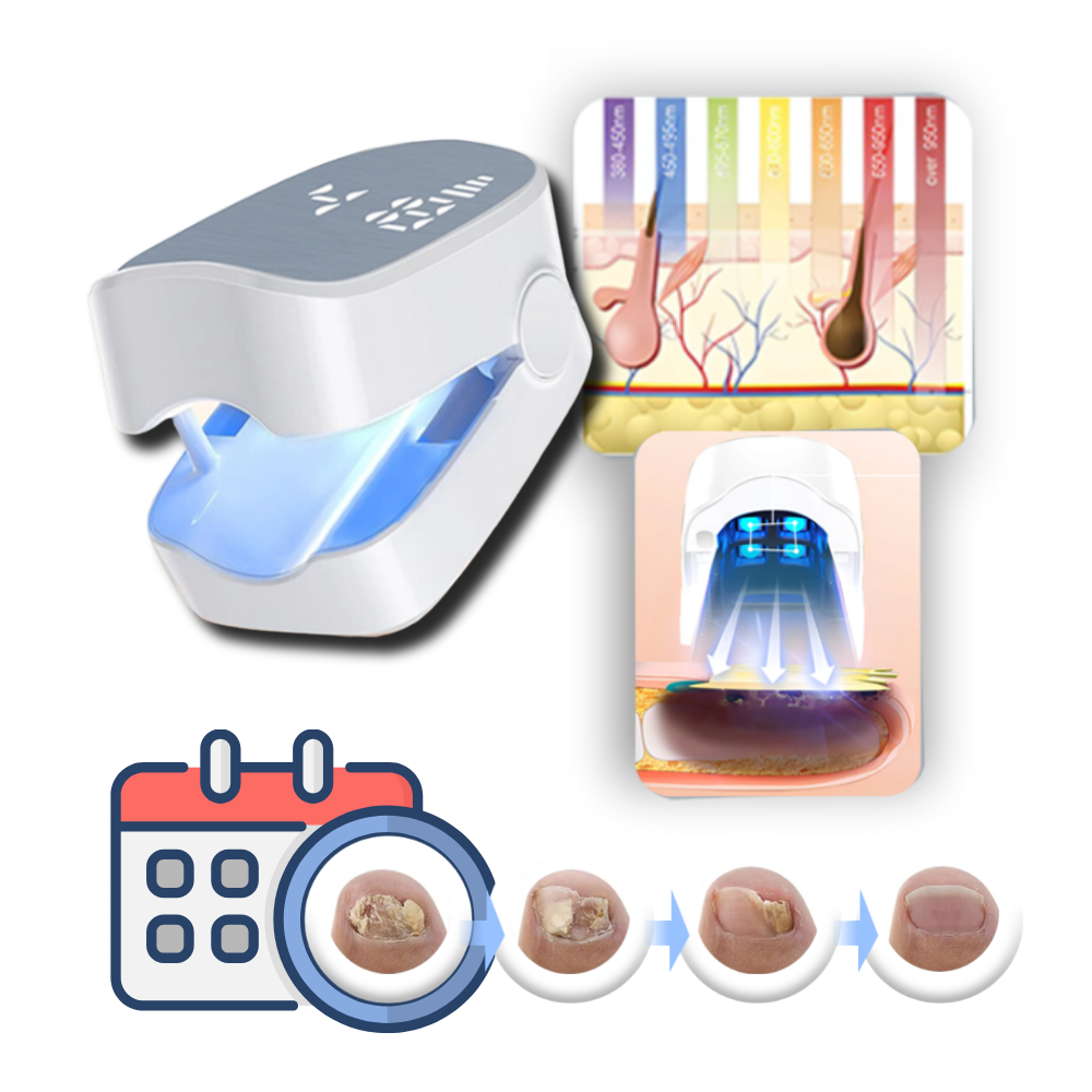 Advanced Laser Nail Care Device with Blue Light Therapy