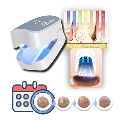 Advanced Laser Nail Care Device with Blue Light Therapy