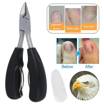 Ultimate Nail Clippers for Thick Nails - Set of 2