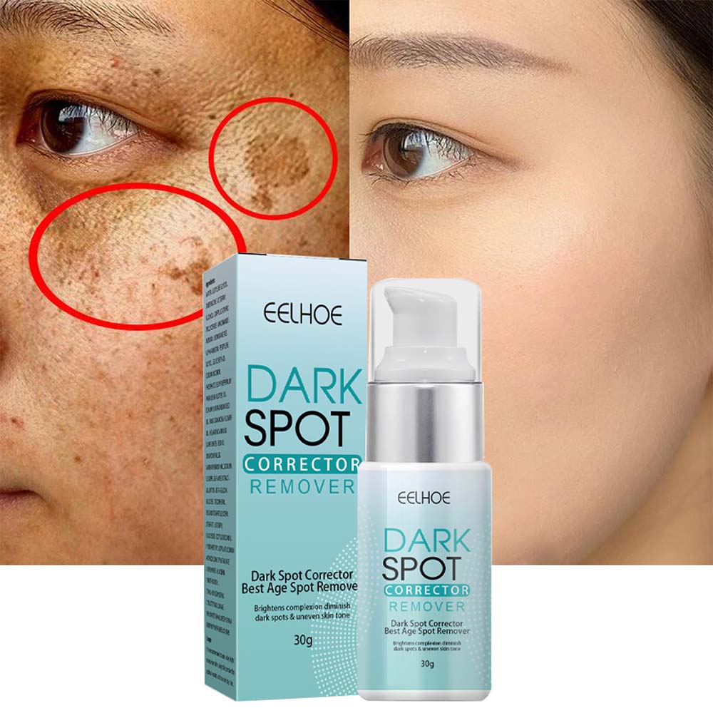Brightening Cream for Spot Reduction and Hydration