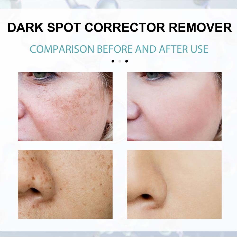 Brightening Cream for Spot Reduction and Hydration