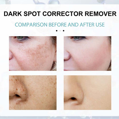 Brightening Cream for Spot Reduction and Hydration