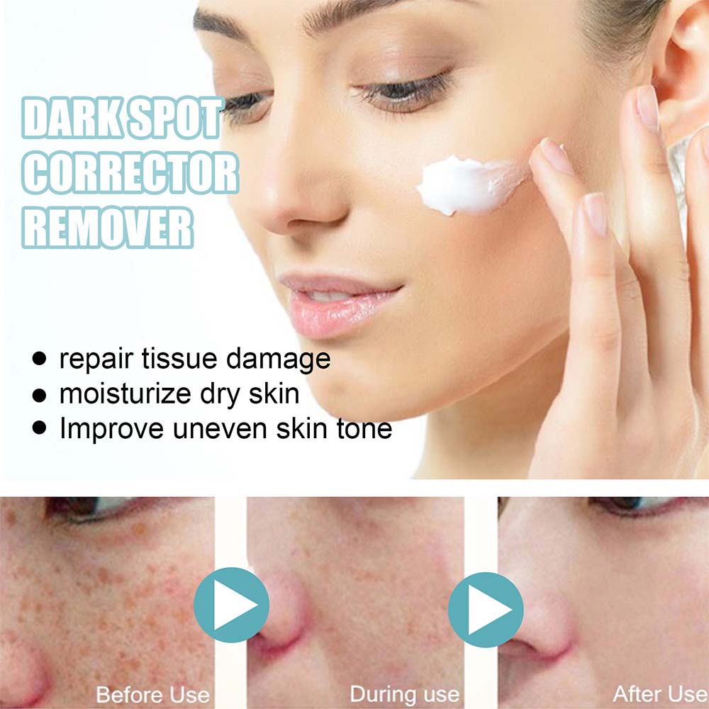 Brightening Cream for Spot Reduction and Hydration