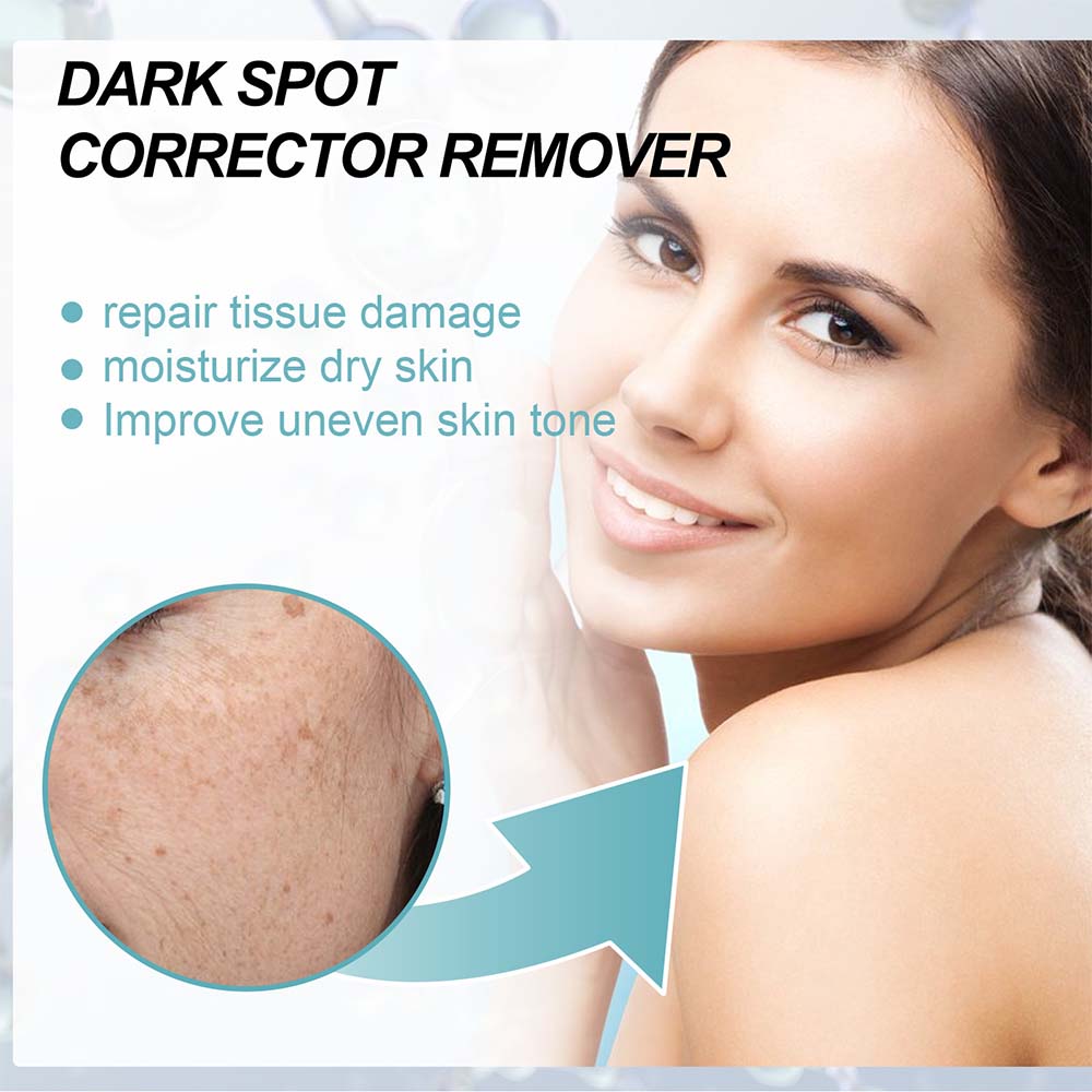 Brightening Cream for Spot Reduction and Hydration