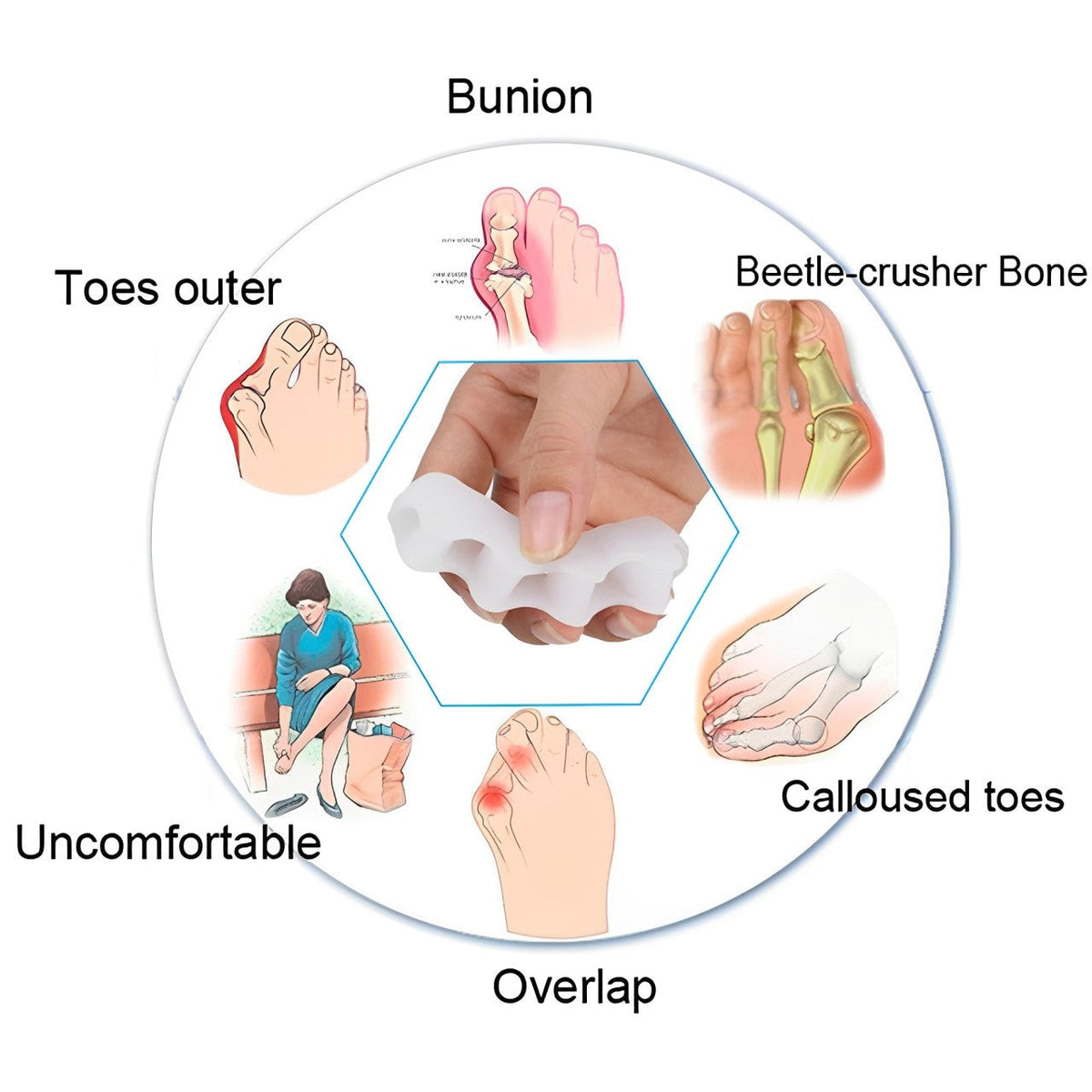 Toe Alignment Support Brace for Ultimate Comfort