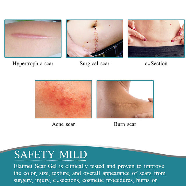 Skin-friendly Scar Treatment Sheet with Water-Resistant Adhesive