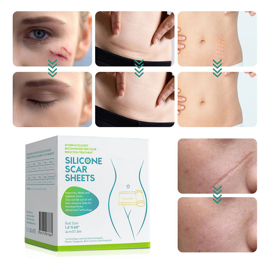 Skin-friendly Scar Treatment Sheet with Water-Resistant Adhesive