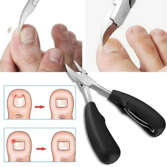 Ultimate Nail Clippers for Thick Nails - Set of 2