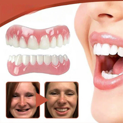 Custom Fit Silicone Denture Stabilization Kit for Comfort