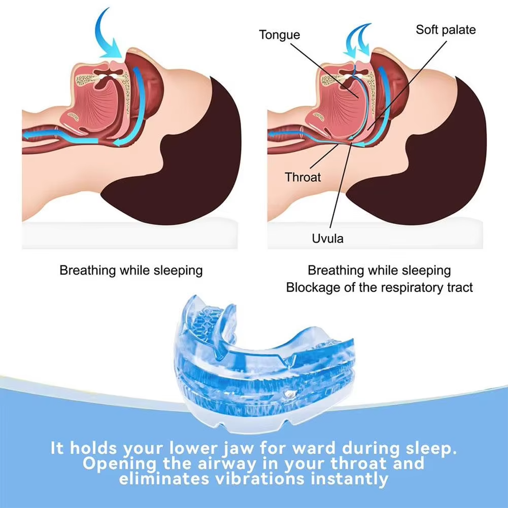 Customizable Jaw Support Device for Snoring Relief