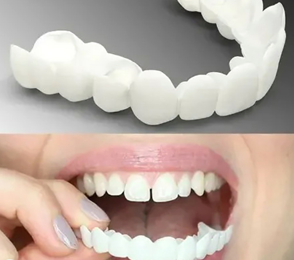 Easy-Fit Denture Covers for Natural Smiles