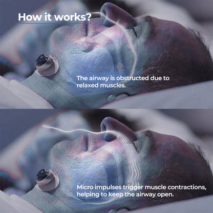 Chin Clip Device for Sleep Support | Anti-Snoring Ergonomic Design