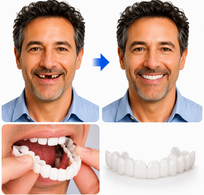 Temporary Tooth Replacement Kit - Custom-Fit Natural Smile Enhancer