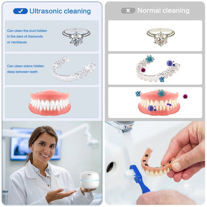 360° UV-C Sterilizing Ultrasonic Tooth Cleaner for Dental Care