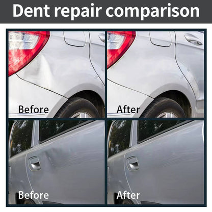Ultimate DIY Car Dent Repair Kit for Effortless Home Fixes
