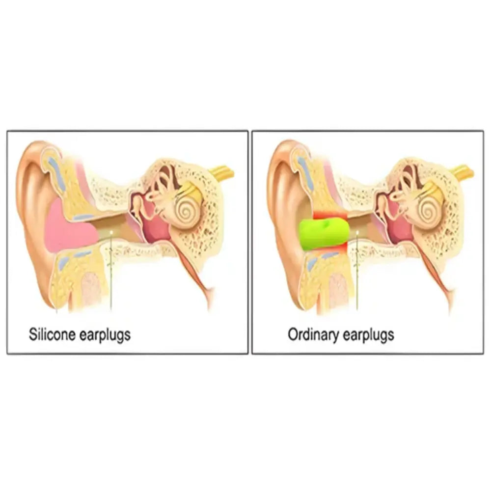Silicone Noise-Blocking Earplugs for Restful Nights