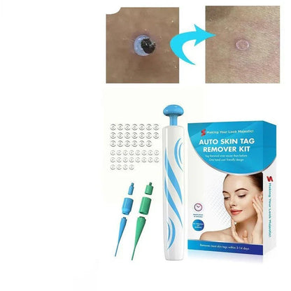 Precision Tool for Safe Skin Tag Removal at Home