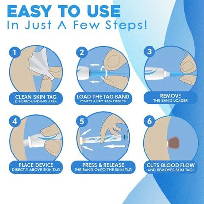 Precision Tool for Safe Skin Tag Removal at Home