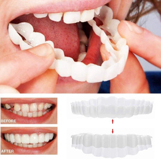 Customizable Smile Enhancement Kit for Temporary Use