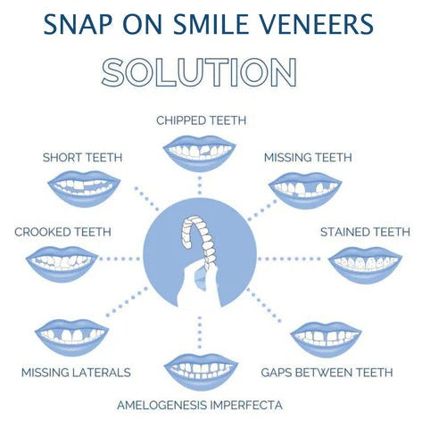 Customizable Smile Enhancement Kit for Temporary Use