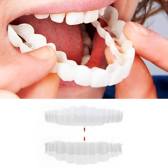 Customizable Smile Enhancement Kit for Temporary Use