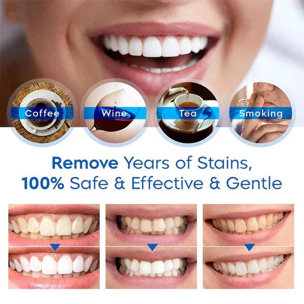 Compact Teeth Brightening Pen for Effortless Whitening