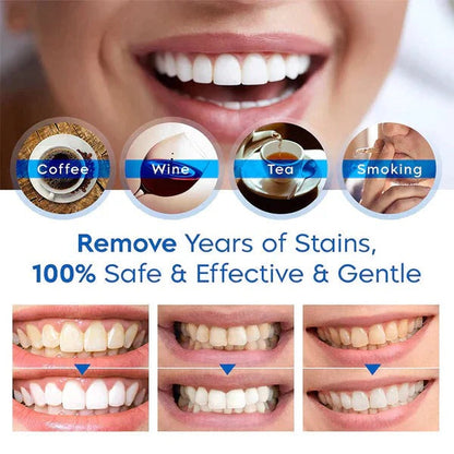 Compact Teeth Brightening Pen for Effortless Whitening