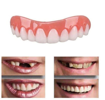 Temporary Smile Enhancer for a Confident Appearance