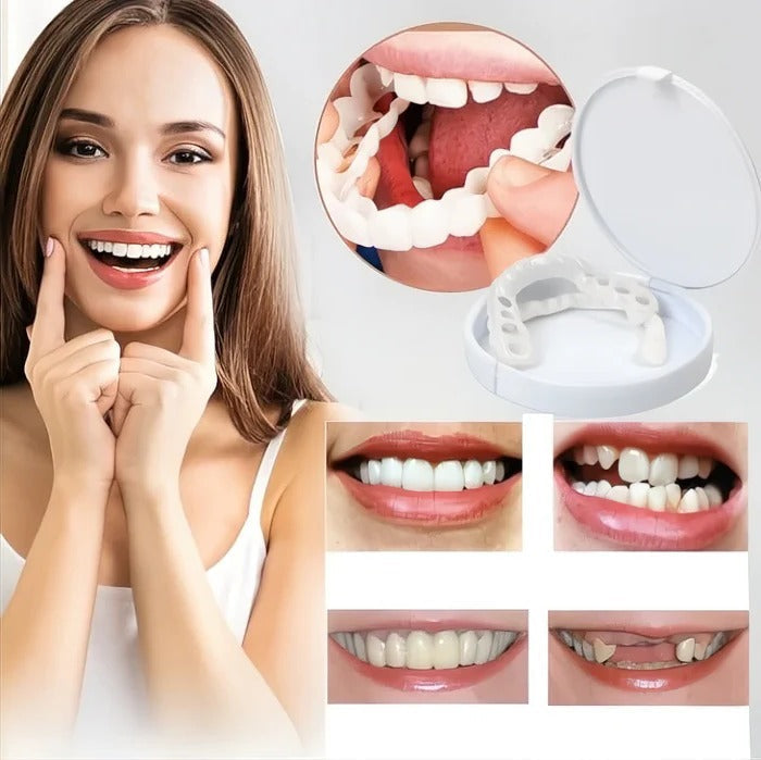 Reusable Teeth Covers for a Bright, Natural Smile – Perfect for Events