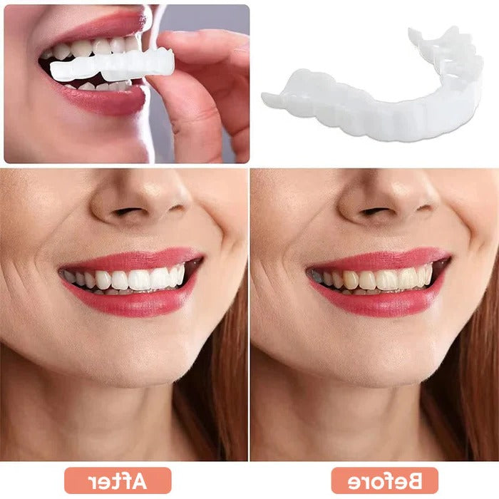 Reusable Teeth Covers for a Bright, Natural Smile – Perfect for Events