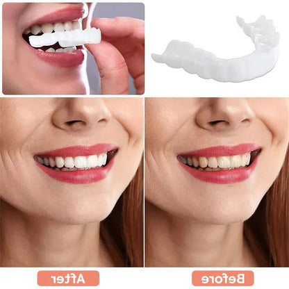 Reusable Teeth Covers for a Bright, Natural Smile – Perfect for Events