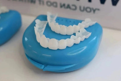 Reusable Teeth Covers for a Bright, Natural Smile – Perfect for Events