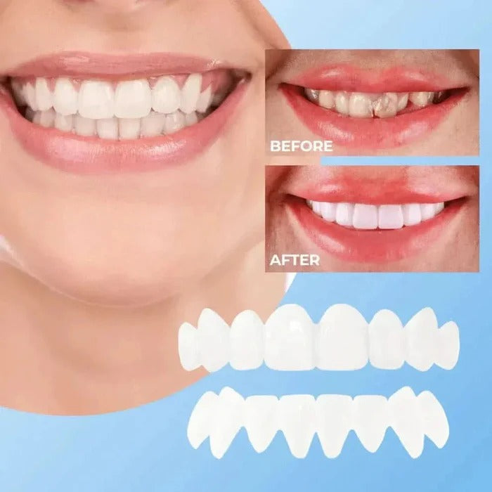 Reusable Teeth Covers for a Bright, Natural Smile – Perfect for Events