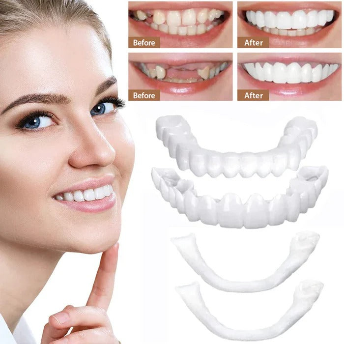 Reusable Teeth Covers for a Bright, Natural Smile – Perfect for Events