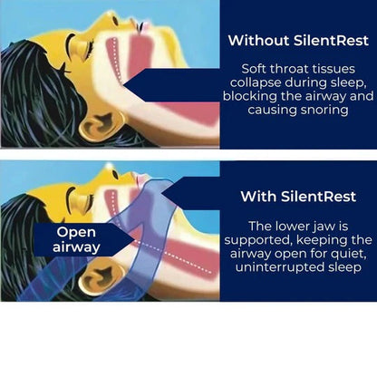 Comfort Fit Jaw Support Strap for Restful Sleep