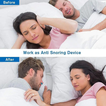 Compact Nasal Airflow Enhancer for Effortless Snoring Relief