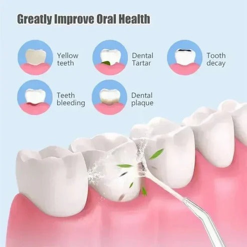 Portable Wireless Water Flosser for Optimal Oral Hygiene