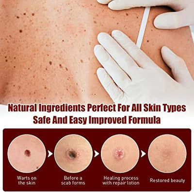 Natural Skin Growth Eliminator with Tea Tree Essence