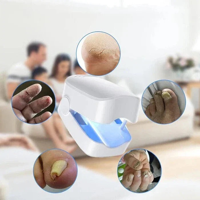 Home Laser Treatment for Nail Fungus with Rechargeable Battery